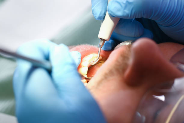 Best Emergency Treatment for Oral Infections in Matteson, IL