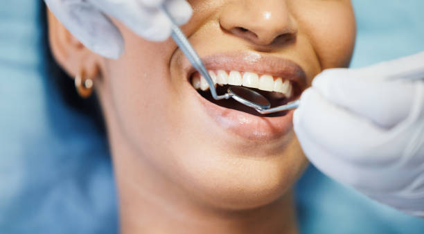 Best Emergency Cosmetic Dentistry (e.g., broken veneers) in Matteson, IL
