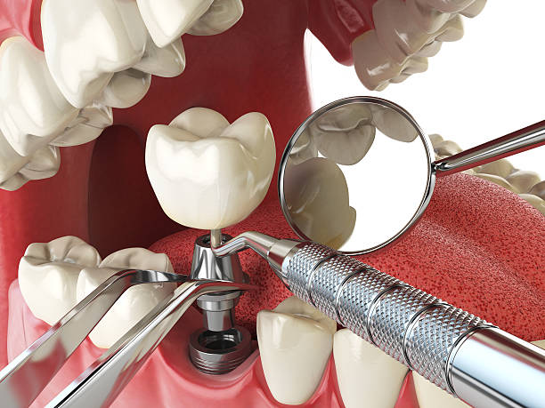 Best Walk-In Emergency Dental Services in Matteson, IL